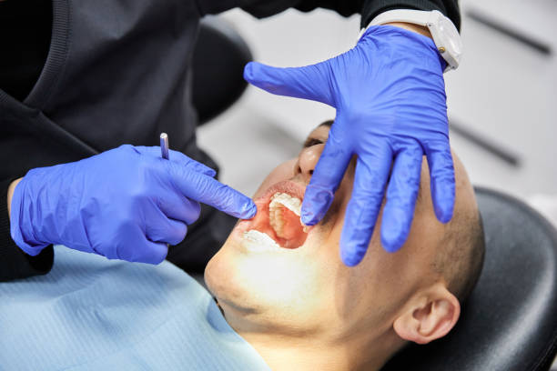 Best Emergency Dental Care for Abscessed Tooth in Shamokin Dam, PA